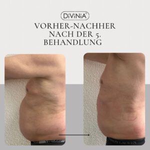 Ergebnisse mit der Divinia Technologie